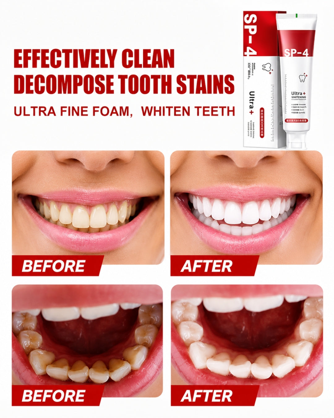 Sp-4 probiotic whitening toothpaste, Teeth Whitener Toothpaste, Natural Tooth Whitener