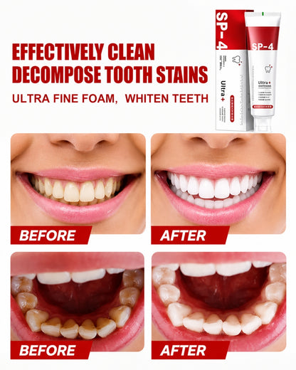 Sp-4 probiotic whitening toothpaste, Teeth Whitener Toothpaste, Natural Tooth Whitener